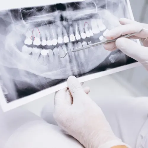 Bucomaxilofacial